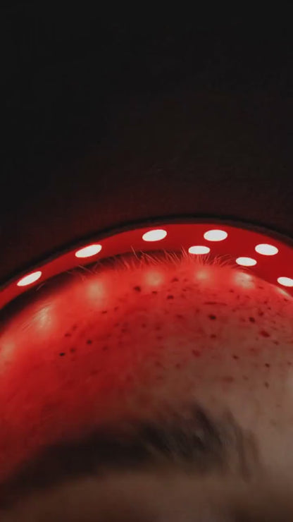 Noélune Red Light Therapy Cap – At-Home Scalp Care Device